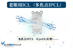 老眼用ICL（多焦点IPCL）