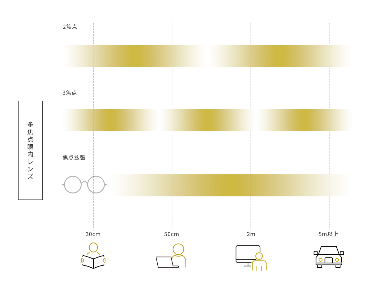 多焦点眼内レンズ